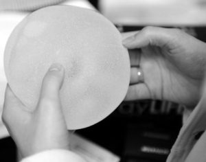 Recommandations concernant les implants mammaires